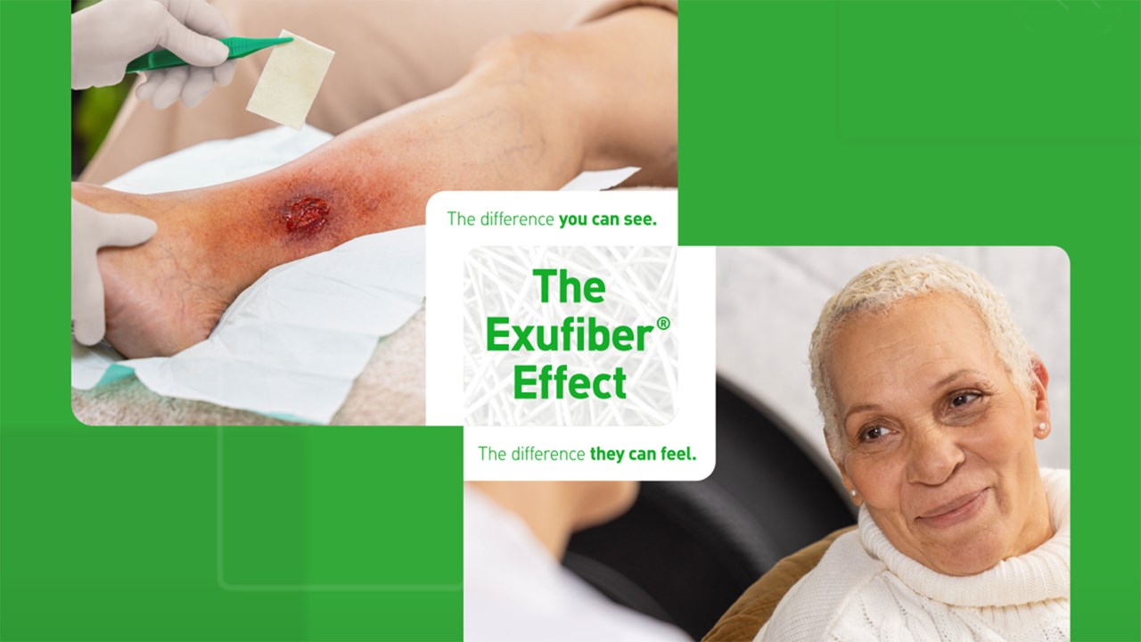 L'effet Exufiber